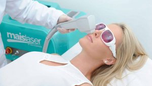 maislaser depilação